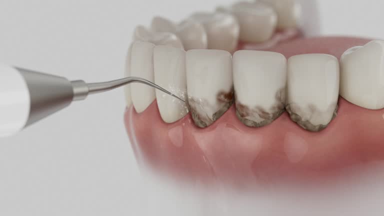 Trusted Teeth Cleaning And Checkup service in Whitehall, MI - Dentist Open Now